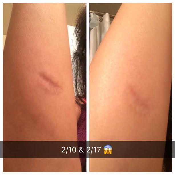scar 4