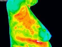 Lymphatic congestion 2