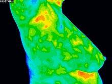 Lymphatic congestion after 2